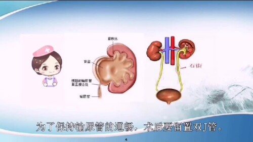 09c1b490c101ef4276e805aede761993.mp4